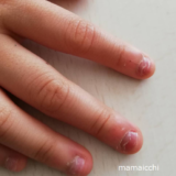 【体験談】7歳の子供の爪噛みの治し方は？早くやめさせる7つの方法をご紹介！
